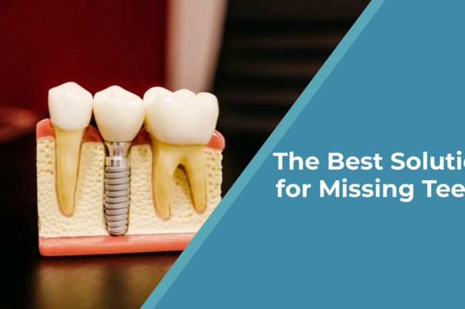 The Best Solution for Missing Teeth in Independence, Ohio